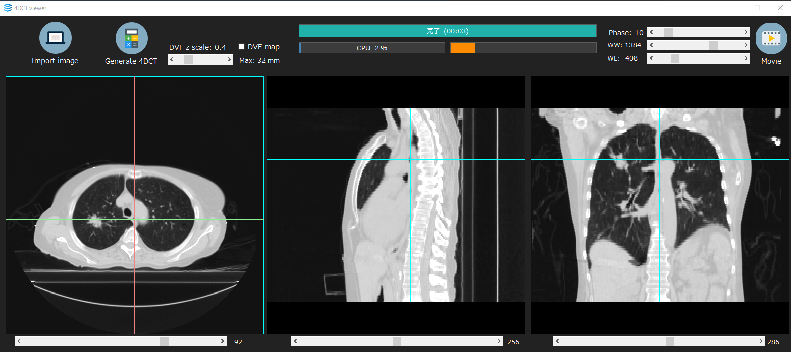 付属の簡易ビューアー（4DCT viewer）の画面